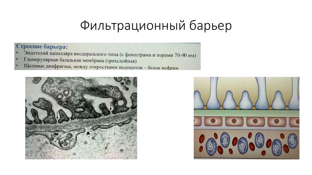 Фильтрационный барьер