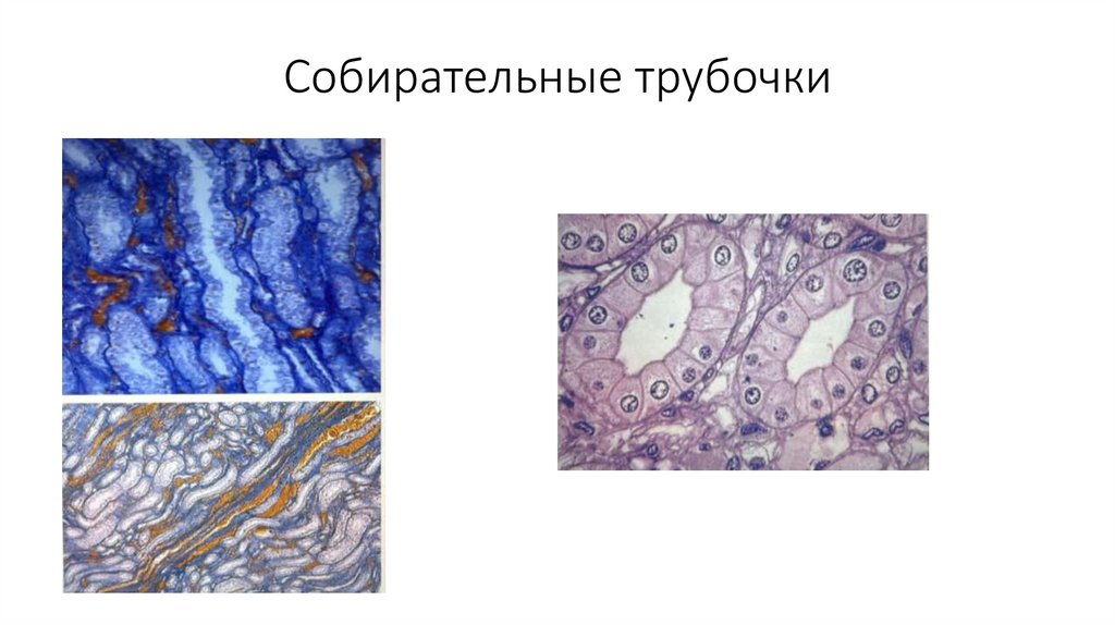 Собирательные трубочки