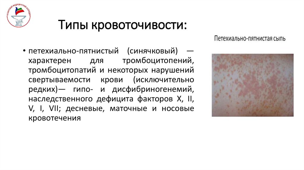 Типы кровоточивости: