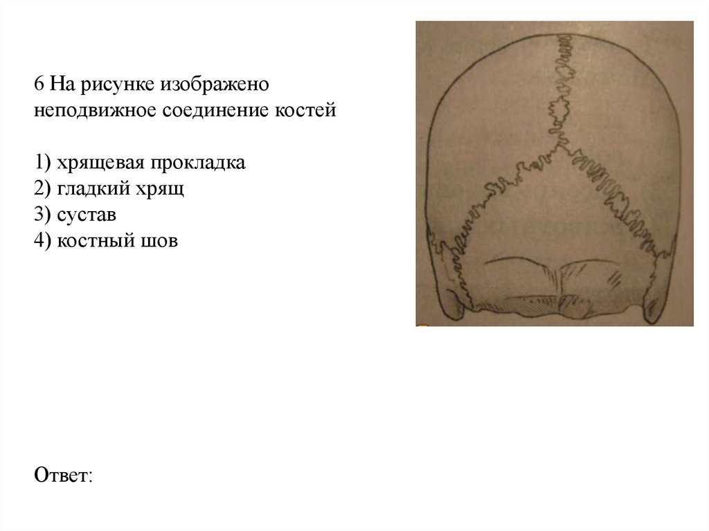 6 На рисунке изображено неподвижное соединение костей 1) хрящевая прокладка 2) гладкий хрящ 3) сустав 4) костный шов Ответ: