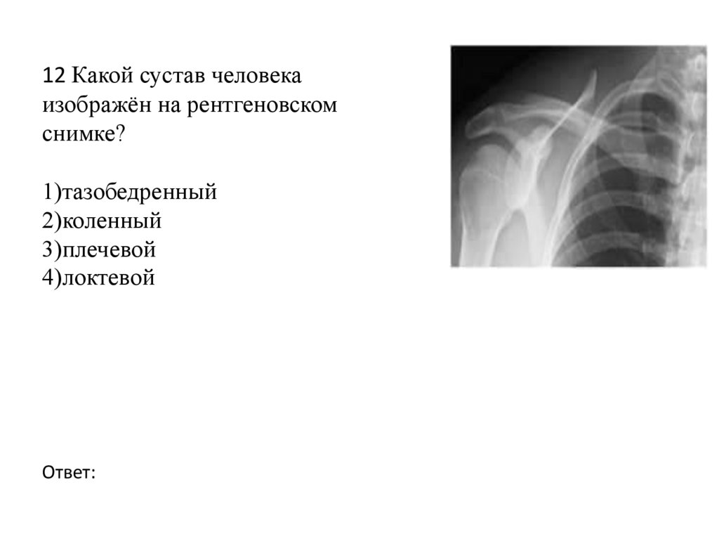 12 Какой сустав человека изображён на рентгеновском снимке? 1)тазобедренный 2)коленный 3)плечевой 4)локтевой Ответ: