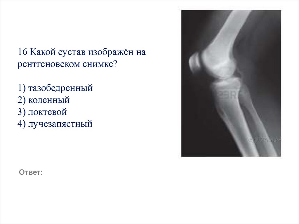 16 Какой сустав изображён на рентгеновском снимке?   1) тазобедренный 2) коленный 3) локтевой 4) лучезапястный