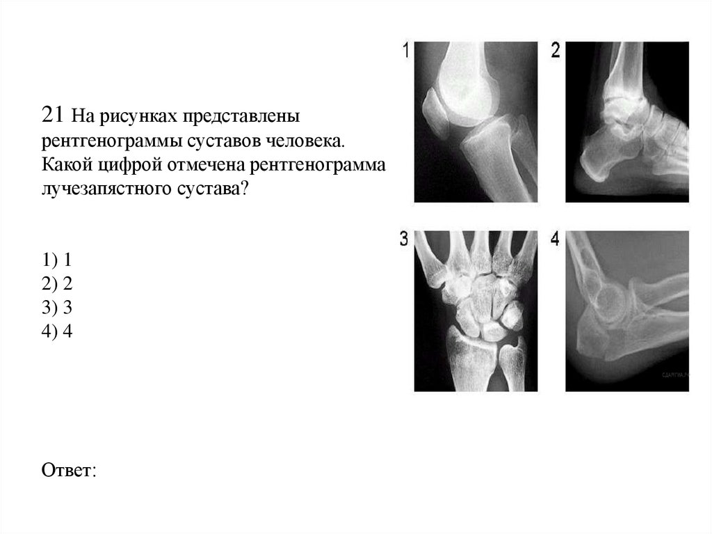 21 На рисунках представлены рентгенограммы суставов человека. Какой цифрой отмечена рентгенограмма лучезапястного сустава? 1) 1