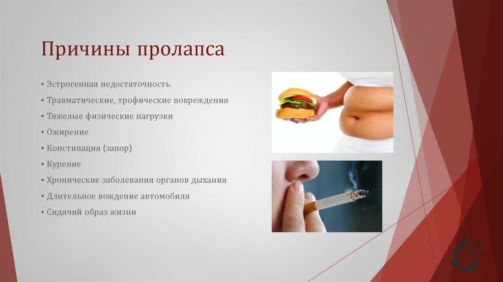 Причины пролапса