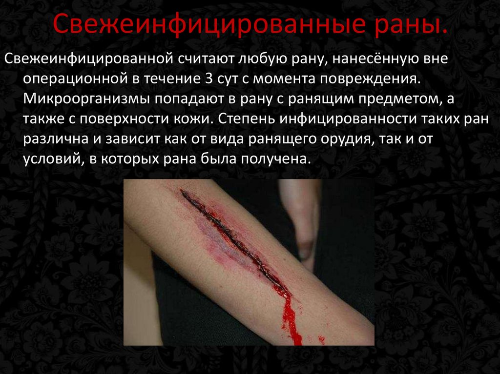 Свежеинфицированные раны.