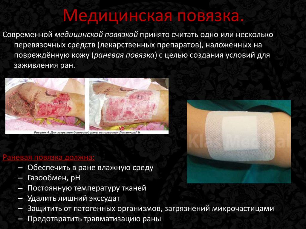 Медицинская повязка.