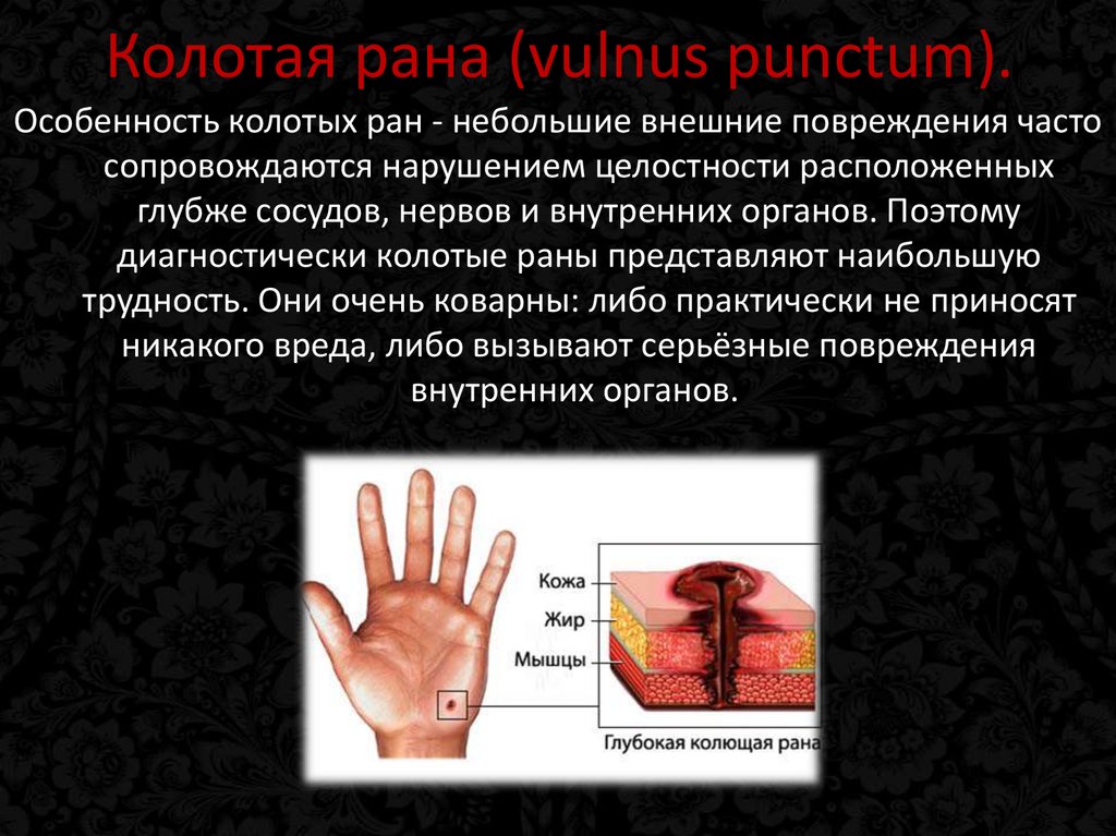 Колотая рана (vulnus punctum).