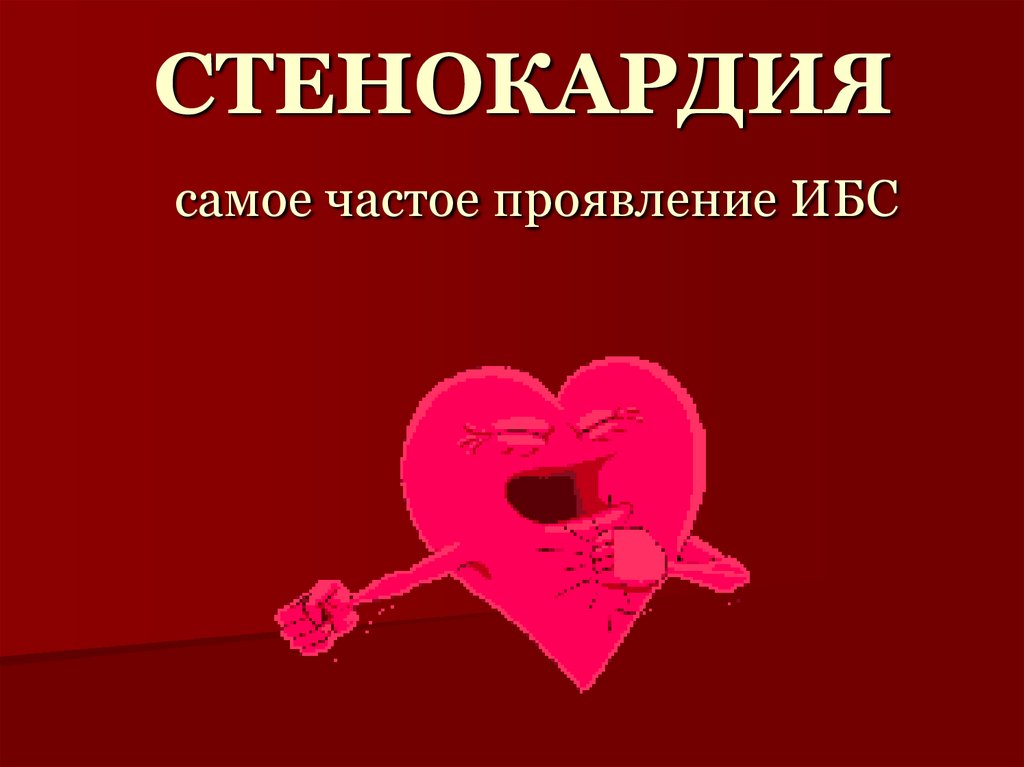 СТЕНОКАРДИЯ самое частое проявление ИБС