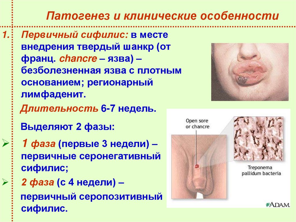 Патогенез и клинические особенности
