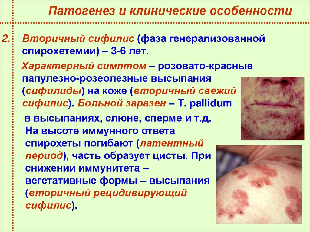 Патогенез и клинические особенности