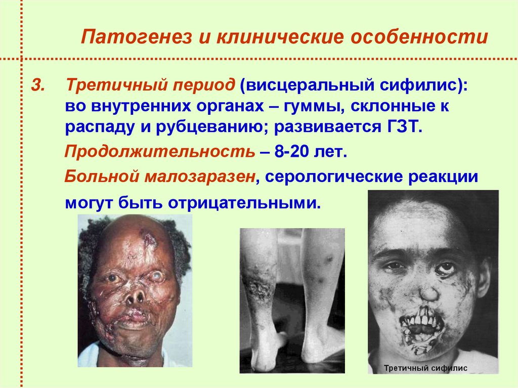 Патогенез и клинические особенности