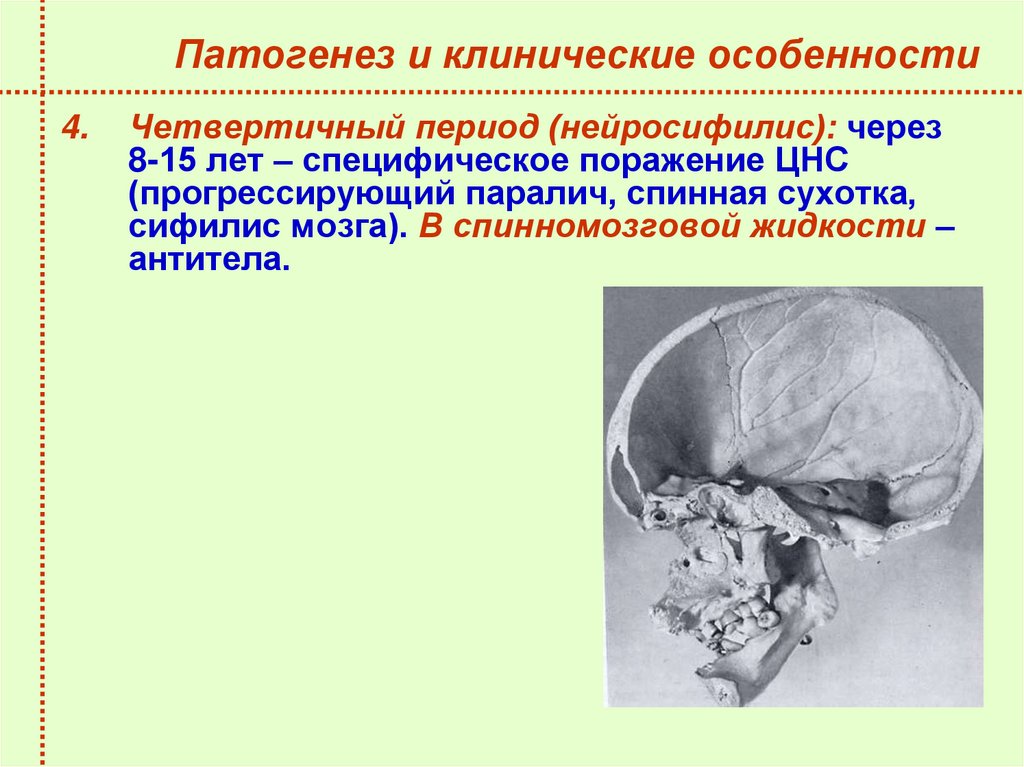 Патогенез и клинические особенности
