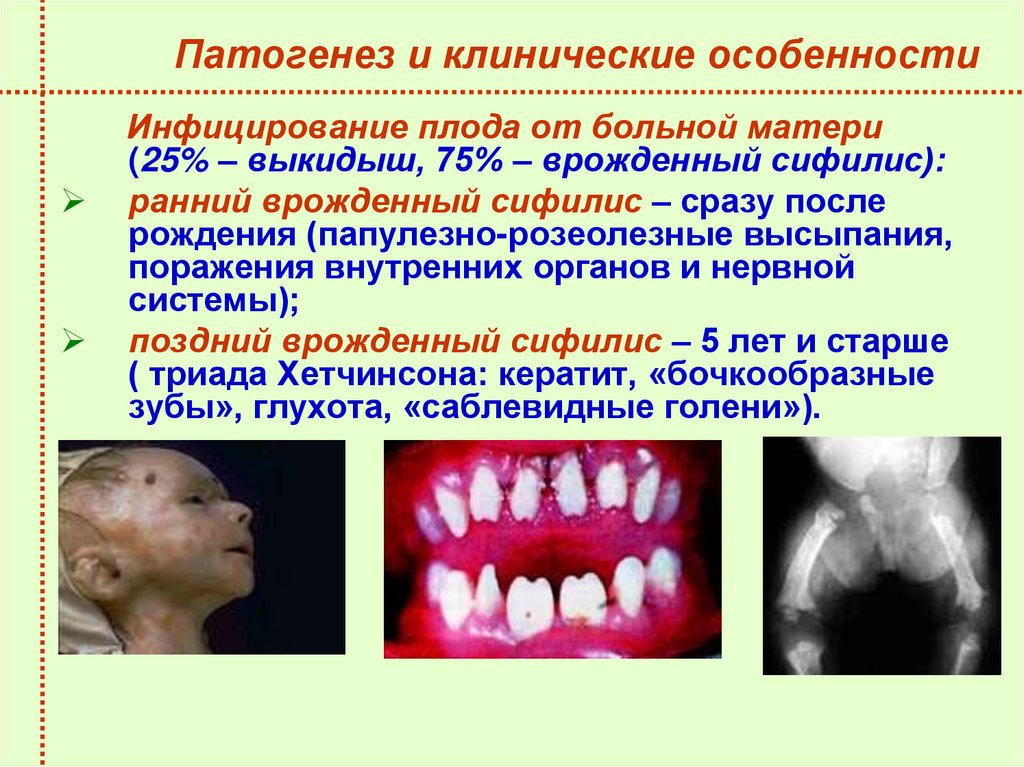 Патогенез и клинические особенности