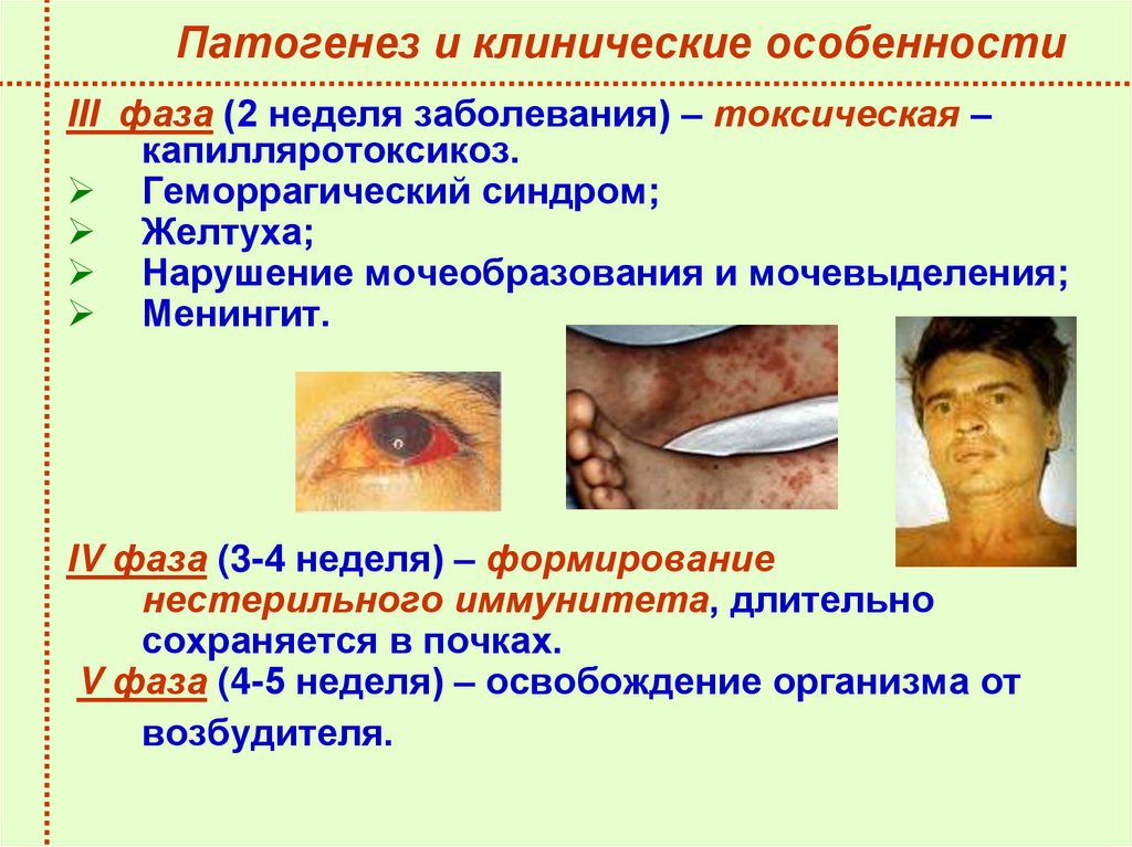 Патогенез и клинические особенности