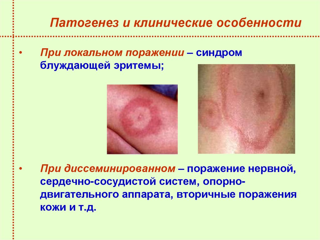 Патогенез и клинические особенности