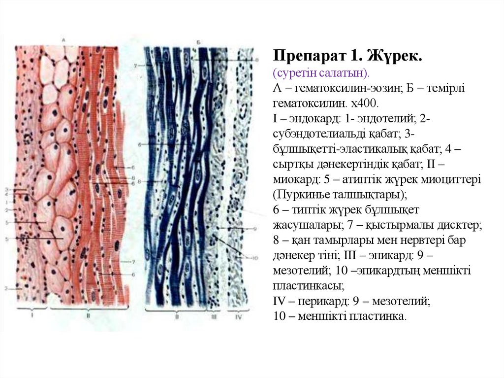 Препарат 1. Жүрек.