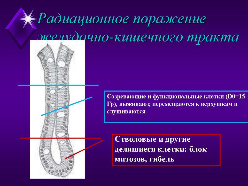 Радиационное поражение желудочно-кишечного тракта