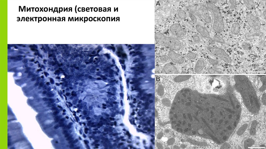 Митохондрия (световая и электронная микроскопия