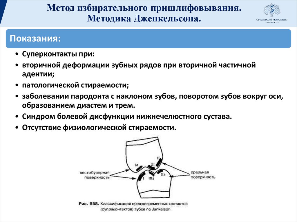 Метод избирательного пришлифовывания. Методика Дженкельсона.