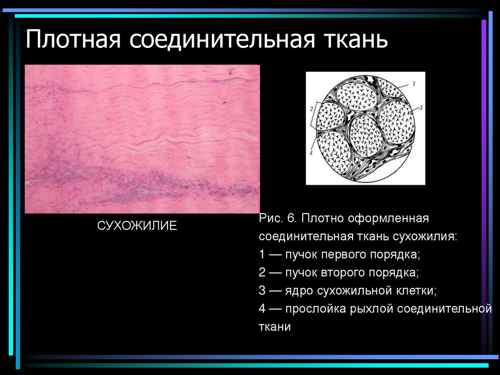 Плотная соединительная ткань