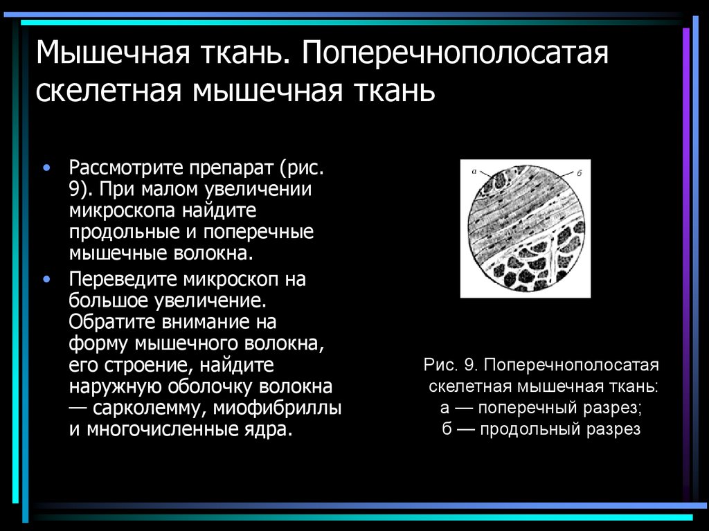 Мышечная ткань. Поперечнополосатая скелетная мышечная ткань