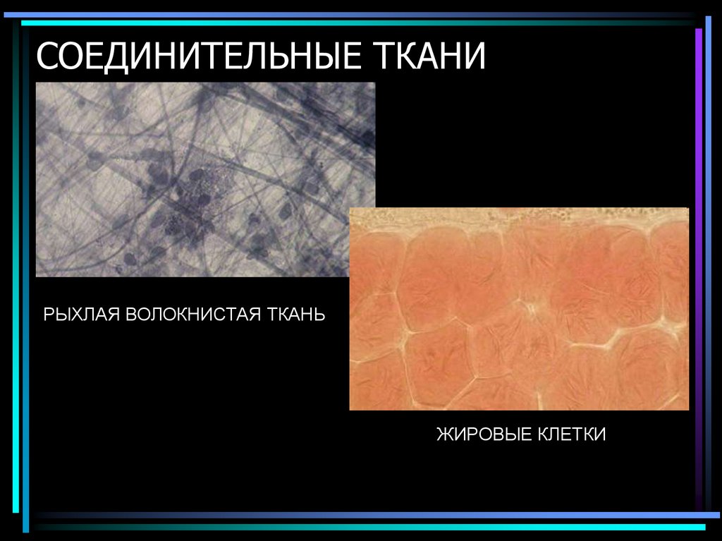 СОЕДИНИТЕЛЬНЫЕ ТКАНИ