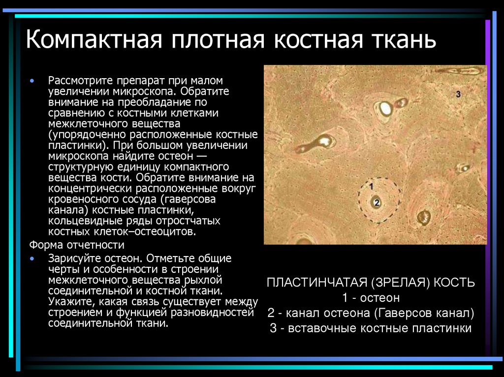 Компактная плотная костная ткань
