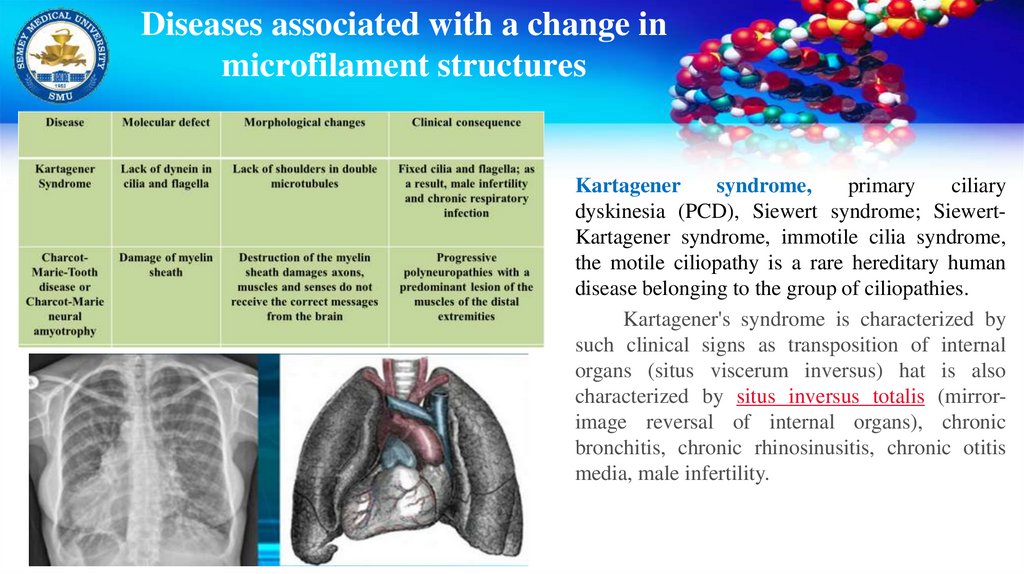 Diseases associated with a change in microfilament structures