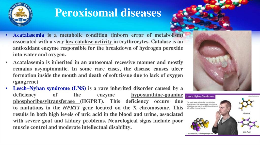Peroxisomal diseases