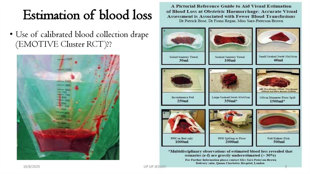 Estimation of blood loss