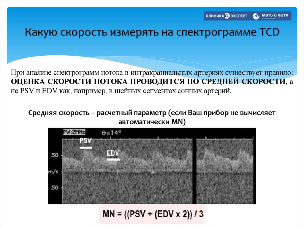 Какую скорость измерять на спектрограмме TCD