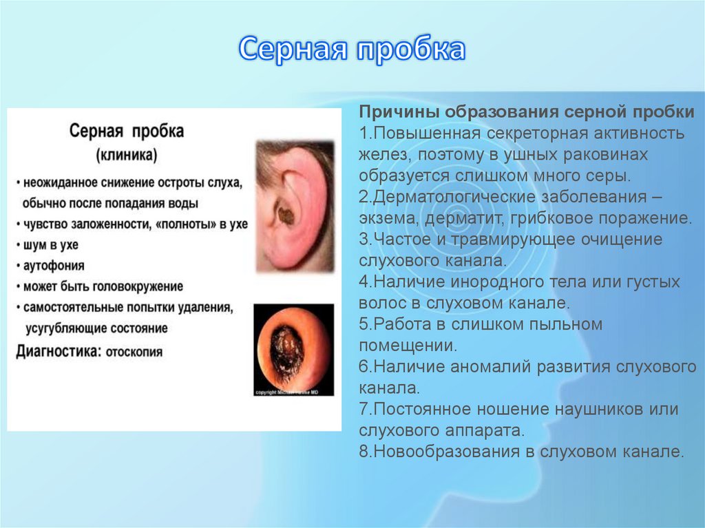 Серная пробка