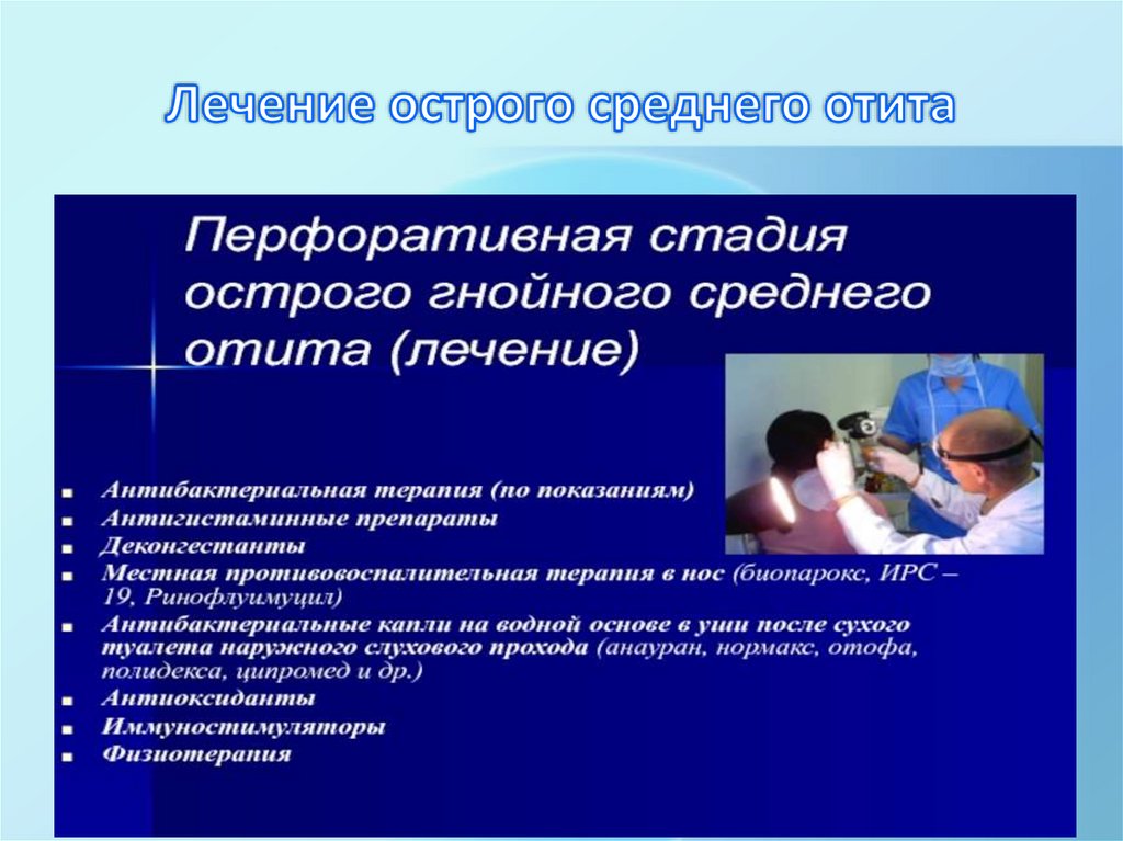 Лечение острого среднего отита