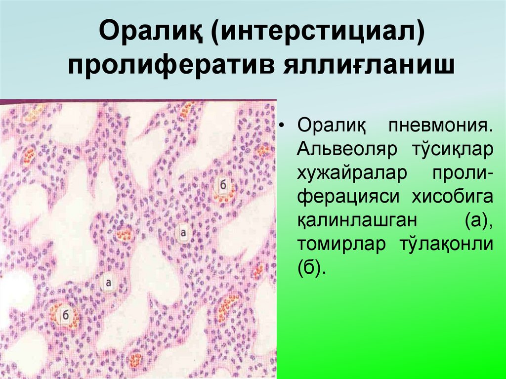 Оралиқ (интерстициал) пролифератив яллиғланиш
