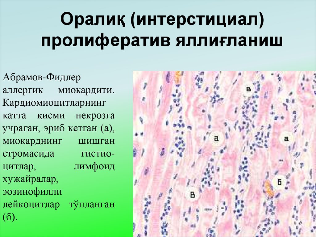 Оралиқ (интерстициал) пролифератив яллиғланиш