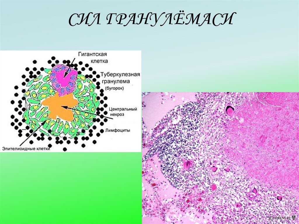 СИЛ ГРАНУЛЁМАСИ