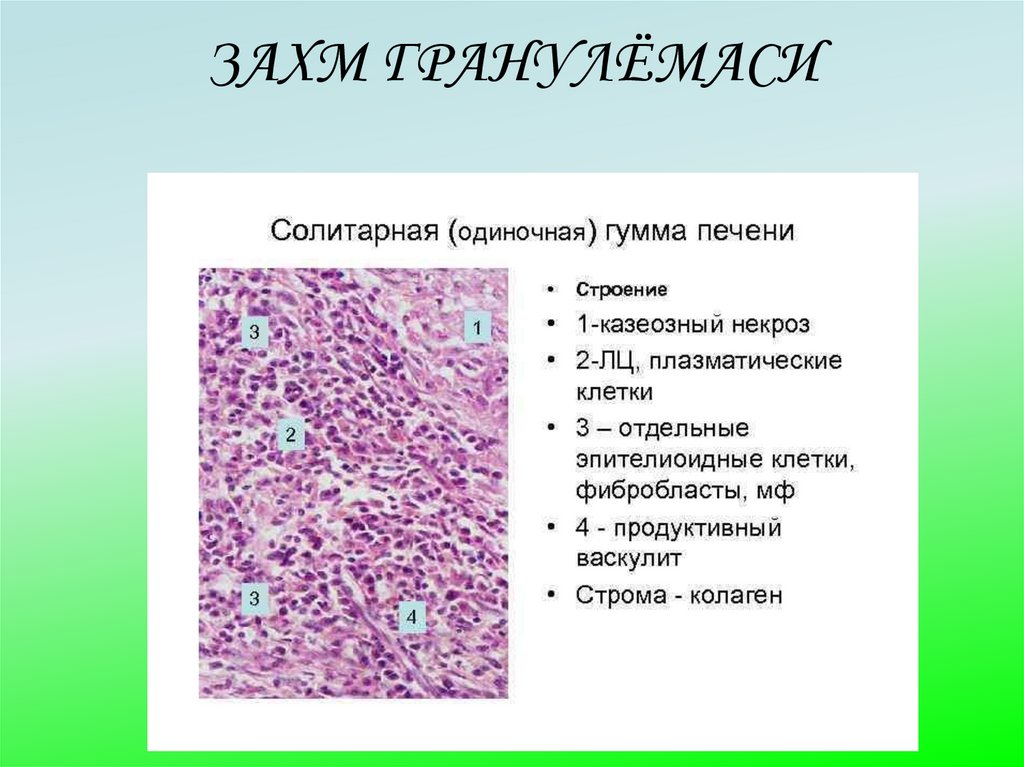 ЗАХМ ГРАНУЛЁМАСИ