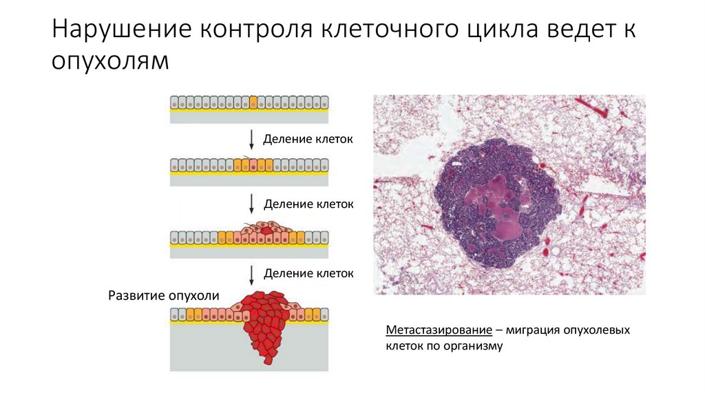 Нарушение контроля клеточного цикла ведет к опухолям