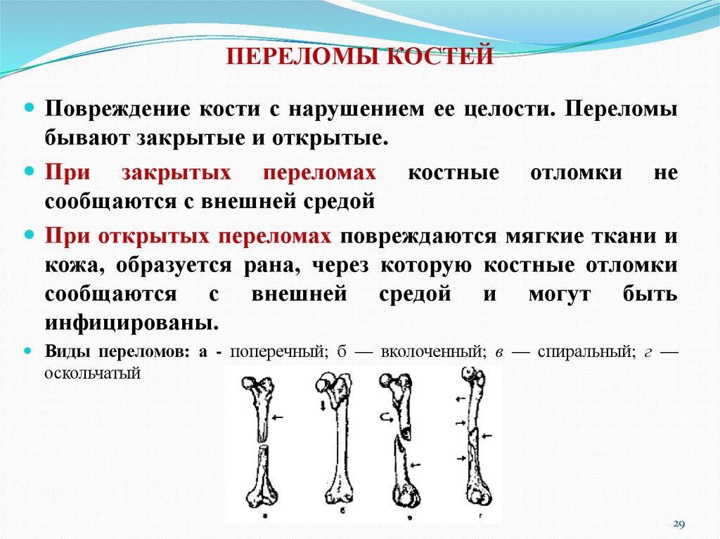 ПЕРЕЛОМЫ КОСТЕЙ
