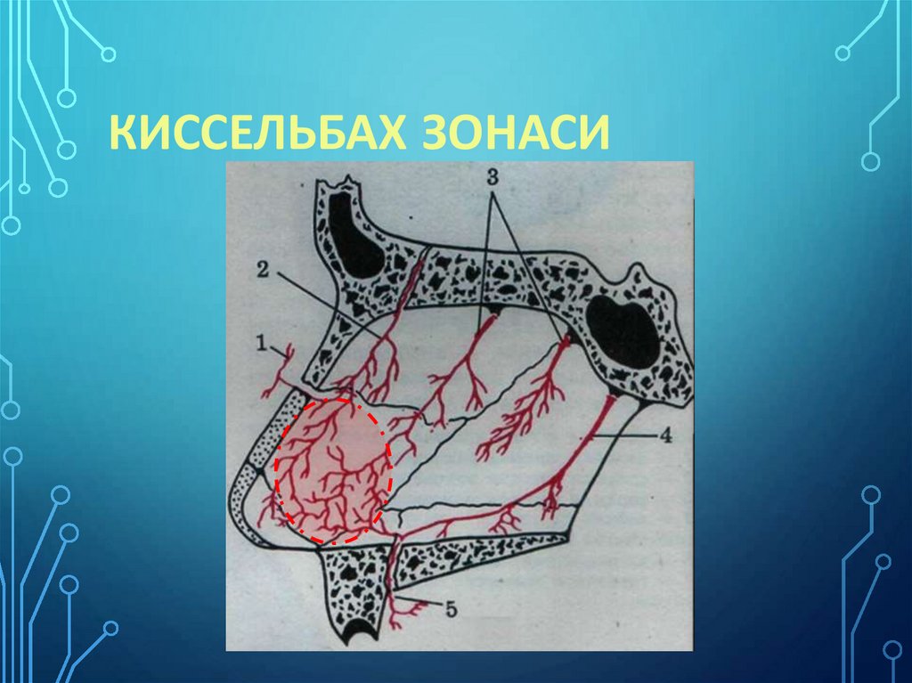 Киссельбах зонаси