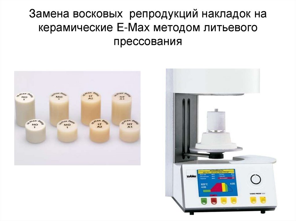 Замена восковых репродукций накладок на керамические E-Max методом литьевого прессования