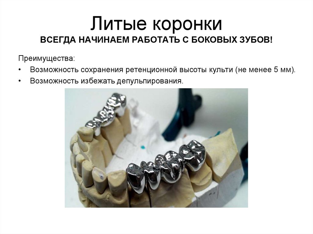 Литые коронки ВСЕГДА НАЧИНАЕМ РАБОТАТЬ С БОКОВЫХ ЗУБОВ!