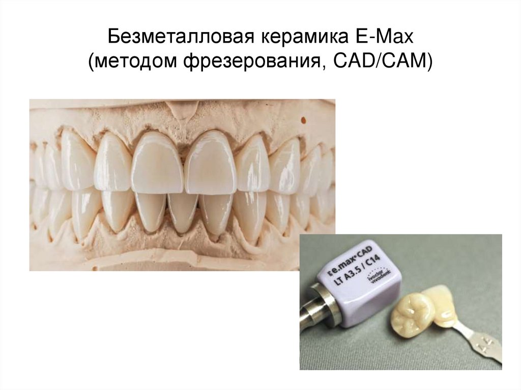 Безметалловая керамика E-Max (методом фрезерования, CAD/CAM)