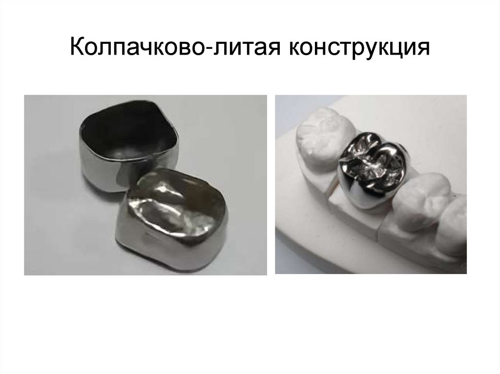 Колпачково-литая конструкция