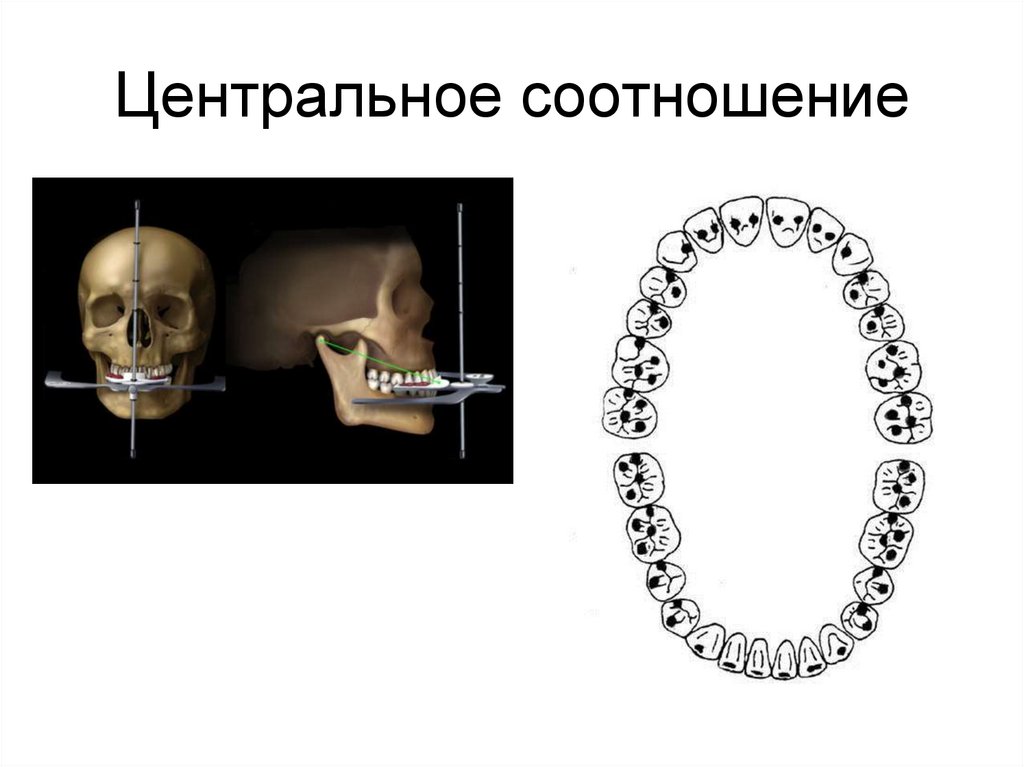 Центральное соотношение