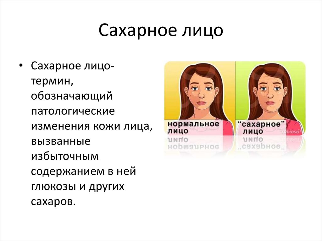 Сахарное лицо