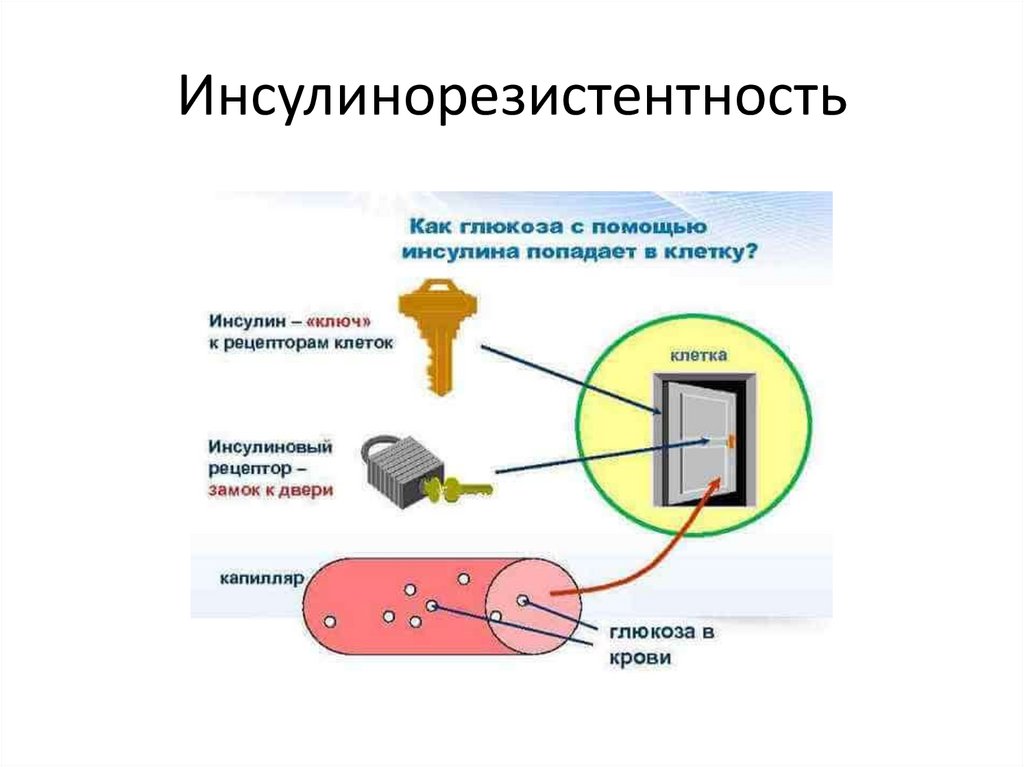 Инсулинорезистентность