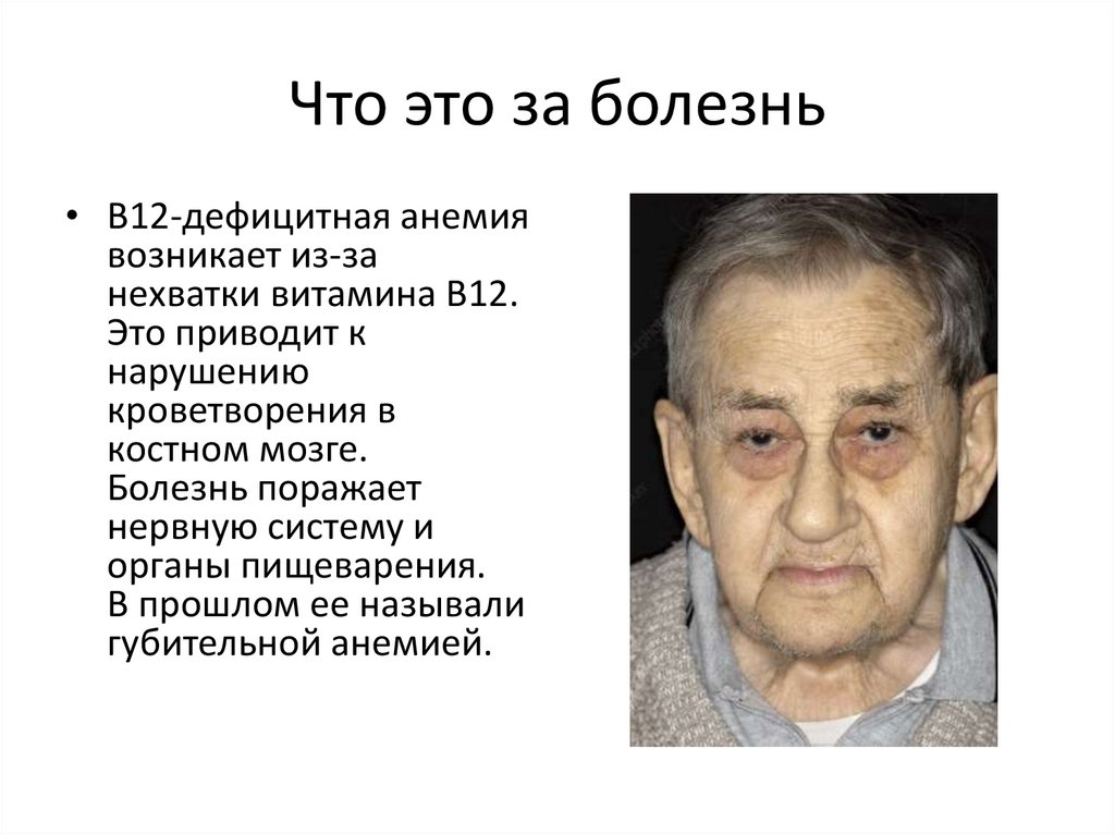 Что это за болезнь
