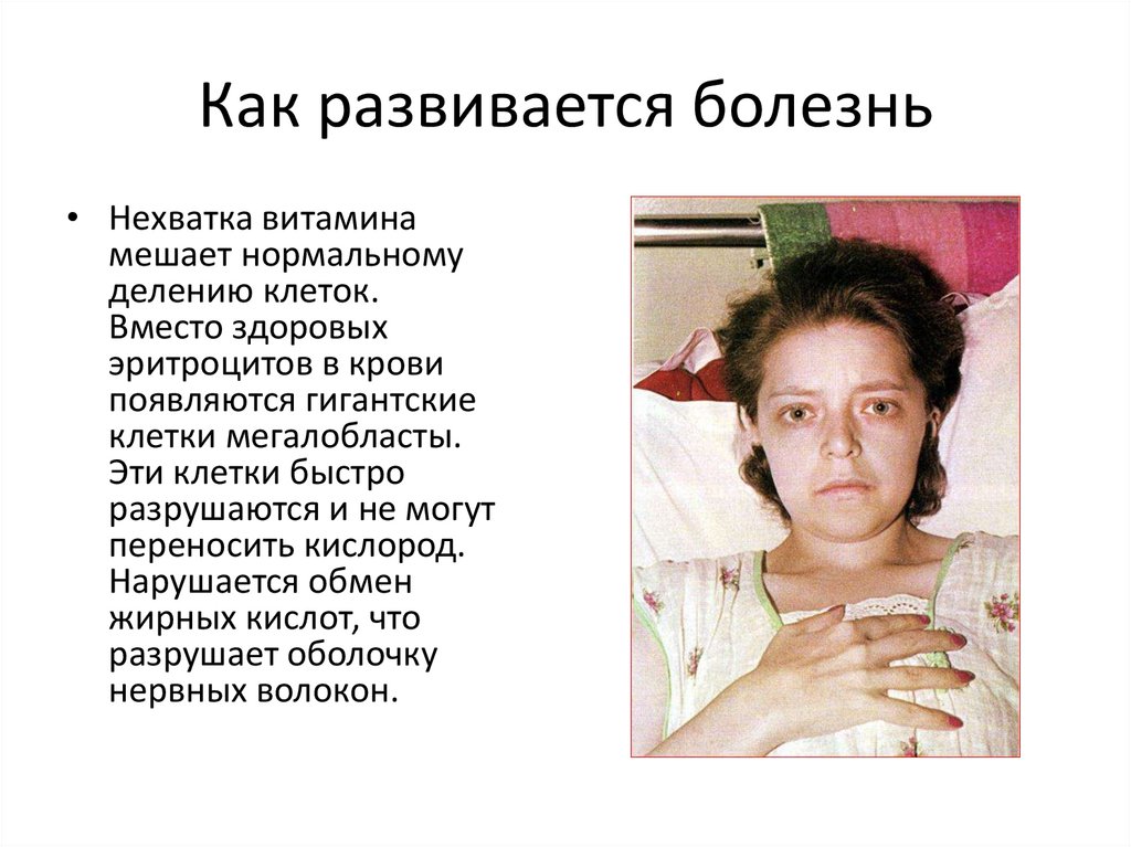 Как развивается болезнь