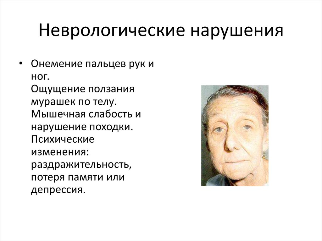 Неврологические нарушения
